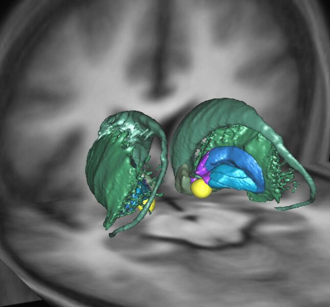 Ventral Pallidum